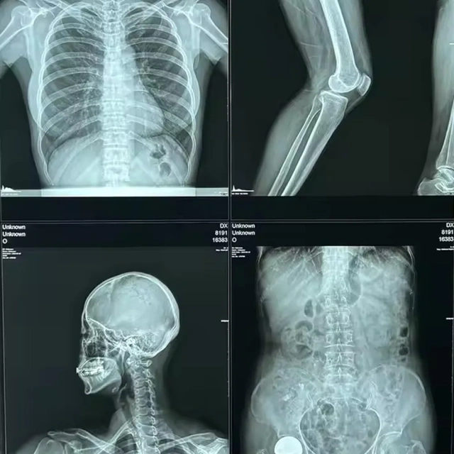 Medical Thermal Film X-ray Film Replaces Film,Fatali Medical equipment