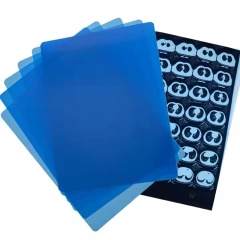 Medical Thermal Film X-ray Film Replaces Film,Fatali Medical equipment