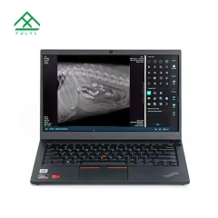 Hospital Equipment 17*17 Wireless Digital Flat Panel Detector Hospital Clinics X-Ray Machines Price Diagnostic Properties,Fatali Medical equipment