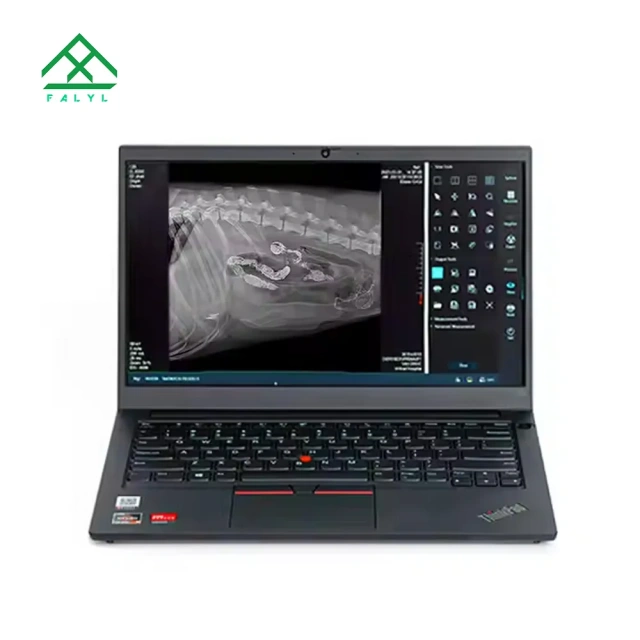 Hospital Equipment 17*17 Wireless Digital Flat Panel Detector Hospital Clinics X-Ray Machines Price Diagnostic Properties,Fatali Medical equipment