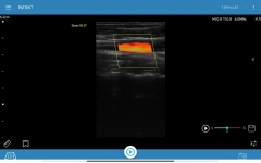 Hospital Handheld Wired Convex Probe Ultrasound Scanner,Fatali Medical equipment