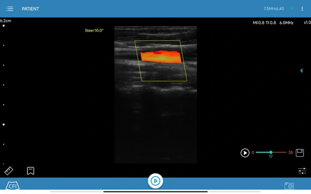Hospital Handheld Wired Convex Probe Ultrasound Scanner,Fatali Medical equipment