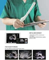 Medical Portable Easy Diagnosis Anywhere Wireless Mini Ultrasound Scanner with 2 Probe,Fatali Medical equipment