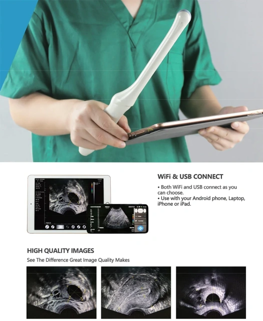 Medical Portable Easy Diagnosis Anywhere Wireless Mini Ultrasound Scanner with 2 Probe,Fatali Medical equipment