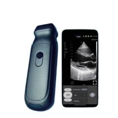 New Portable & Accurate Wireless Mini Ultrasound Scanner with Dual Probes,Fatali Medical equipment