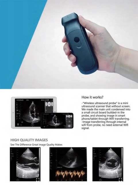 New Portable & Accurate Wireless Mini Ultrasound Scanner with Dual Probes,Fatali Medical equipment