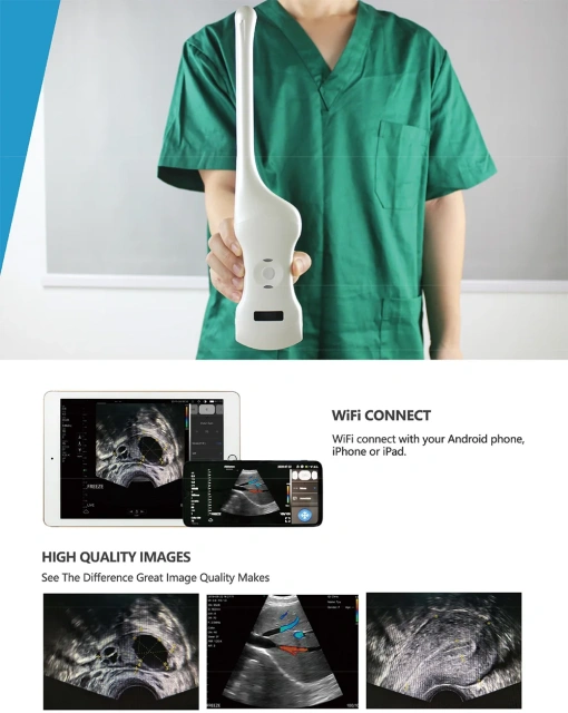 Medical Portable Wireless 3D Laptop Diagnostic Ultrasound Machine for Surface and Vaginal Examination,Fatali Medical equipment