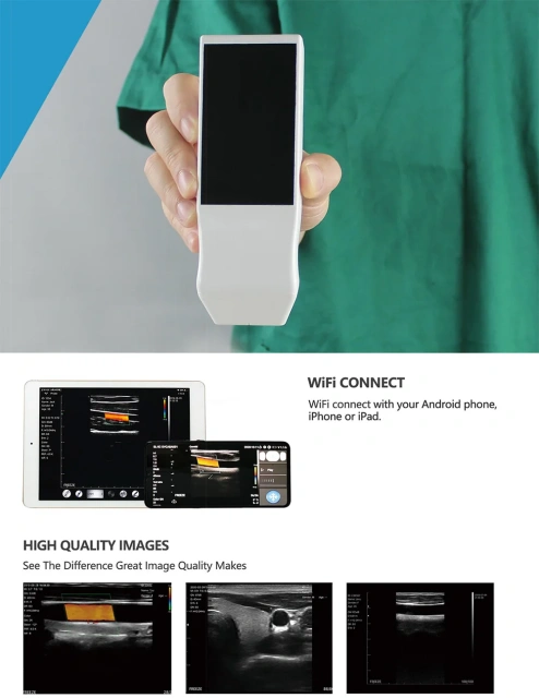 Hospital Portable Wireless Ultrasound Machine - Easy Diagnosis Anywhere,Fatali Medical equipment