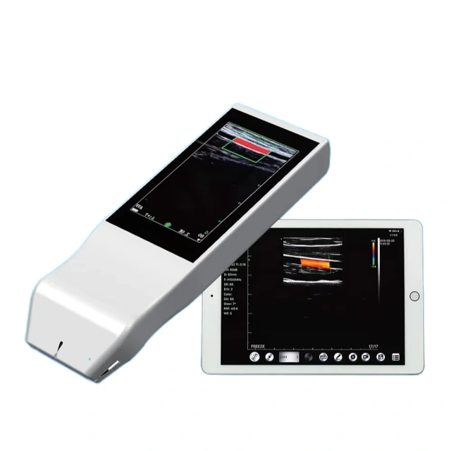 Hospital Portable Wireless Ultrasound Machine - Easy Diagnosis Anywhere,Fatali Medical equipment