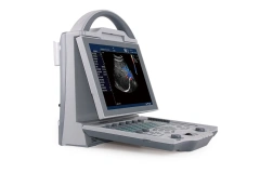 Durable Fast Diagnostic ICU Ultrasonido Doppler Color With 4d Probe for Human or Veterinary,Fatali Medical equipment