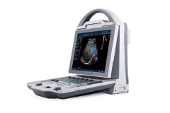 Durable Fast Diagnostic ICU Ultrasonido Doppler Color With 4d Probe for Human or Veterinary,Fatali Medical equipment