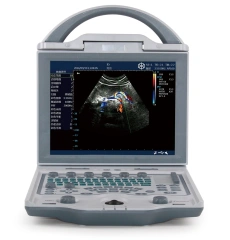 Durable Fast Diagnostic ICU Ultrasonido Doppler Color With 4d Probe for Human or Veterinary,Fatali Medical equipment