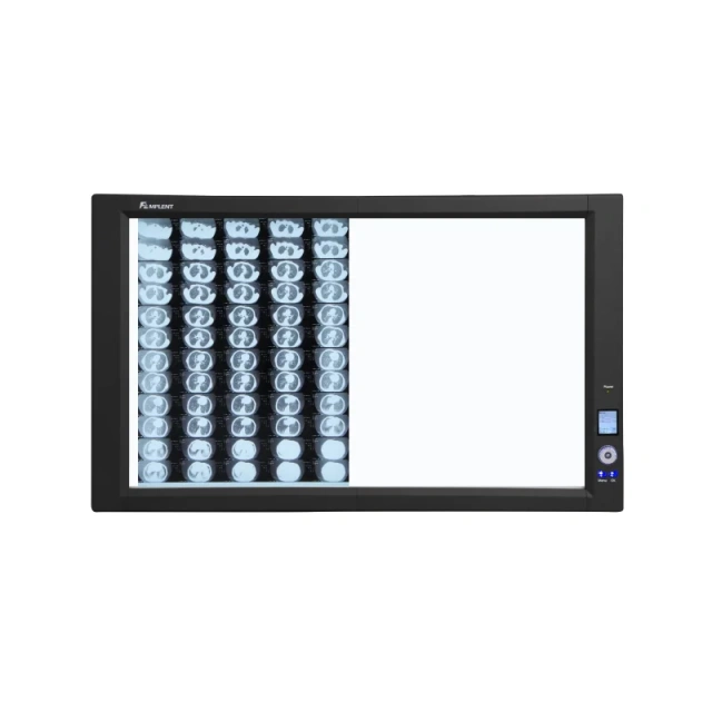 FTL-GPD01 Medical X-ray LED Film Viewer,Fatali Medical equipment