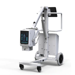 FTLF080-B 8KW/160mA Digital Mobile X-ray Machine Fluoroscopy DR,Fatali Medical equipment