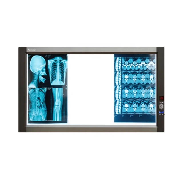 FTL-GPD03 X Ray Machine Triple LED XRay View Box,Fatali Medical equipment