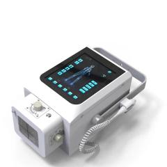 FTLF080-B 8KW/160mA Digital Mobile X-ray Machine Fluoroscopy DR,Fatali Medical equipment