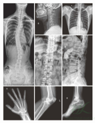 FTLDR-C50 High Frequency Digital X-ray Radiography System,Fatali Medical equipment