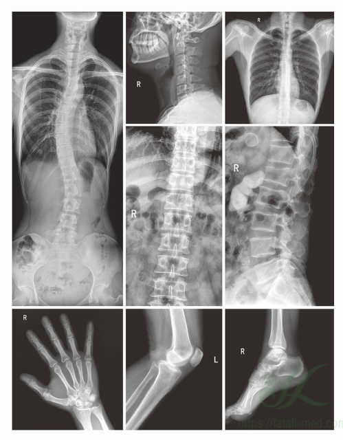 FTLDR-C50 High Frequency Digital X-ray Radiography System,Fatali Medical equipment