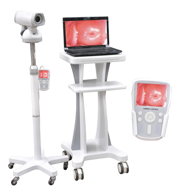 Digital Portable Gynecology Colposcope,Fatali Medical equipment