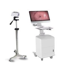 Digital Portable Gynecology Colposcope,Fatali Medical equipment