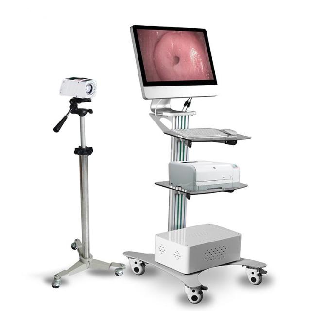 Digital Portable Trolley Gynecology Colposcope,Fatali Medical equipment