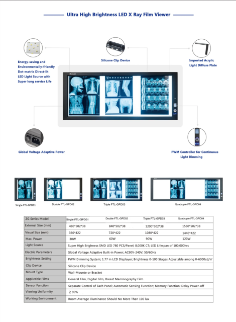 FTL-GPD01 Medical X-ray LED Film Viewer,Fatali Medical equipment