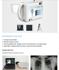 Medical Digital X-Ray Machine Human Animal Handheld Dental X-Ray for Intraoral Scanner,Fatali Medical equipment