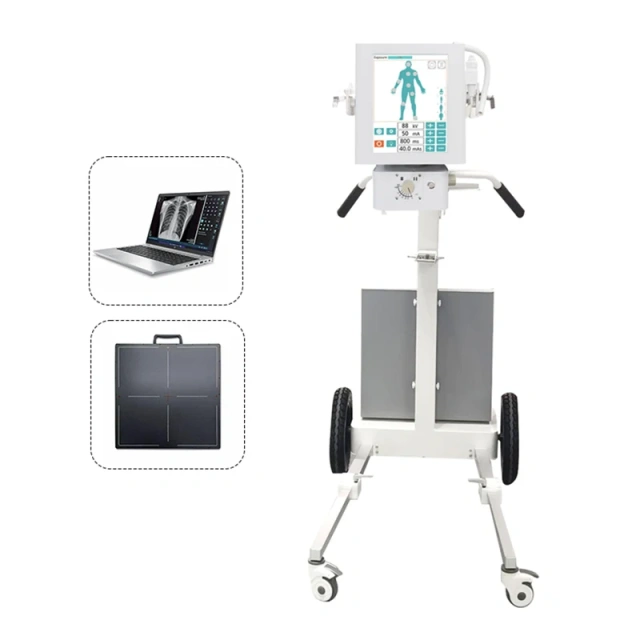 5.6kW Mobile Full Body X-ray Diagnostic System for Hospital,Fatali Medical equipment