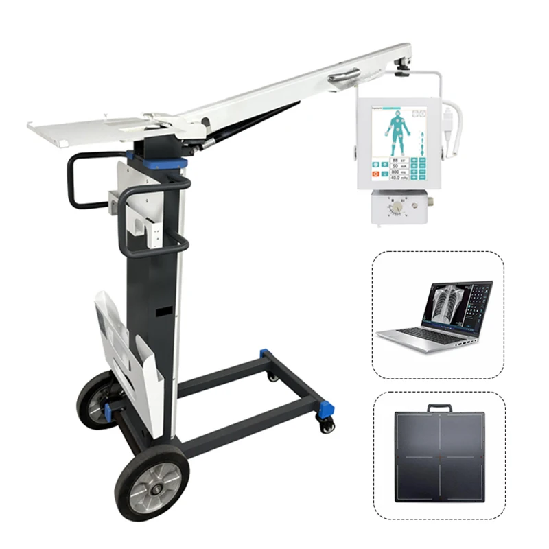 5.6kW Mobile Full Body X-ray Diagnostic System for Hospital