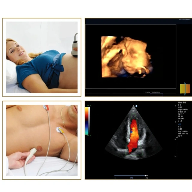 Obgyn 4D Trolley Color Droppler Ultrasound Machine With Convex,Fatali Medical equipment