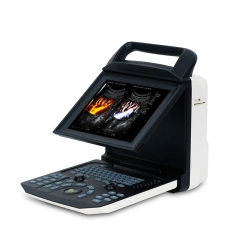 Promotion 3D 4D Portable Color Doppler Ultrasound Scanner / ECHO Machine,Fatali Medical equipment