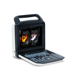 Promotion 3D 4D Portable Color Doppler Ultrasound Scanner / ECHO Machine,Fatali Medical equipment