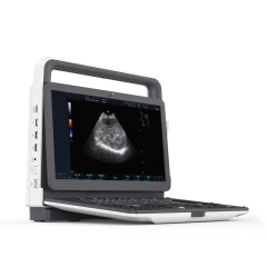 Fatali Promo Portable Digital Ultrasound Machine / Human Ecografo,Fatali Medical equipment