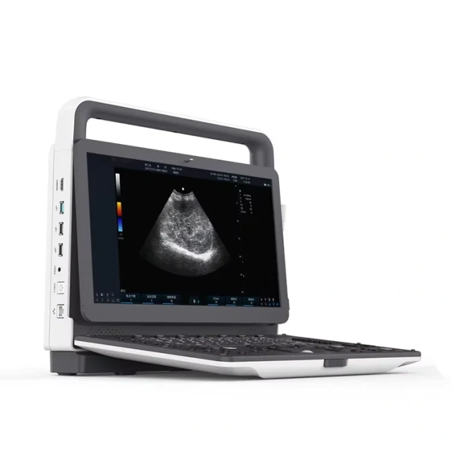 Fatali Promo Portable Digital Ultrasound Machine / Human Ecografo,Fatali Medical equipment
