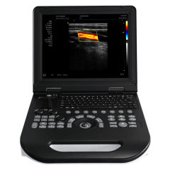 Laptop Ultrasound Machine FTL-E30,Fatali Medical equipment