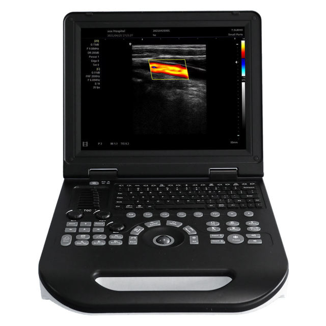 Laptop Ultrasound Machine FTL-E30,Fatali Medical equipment