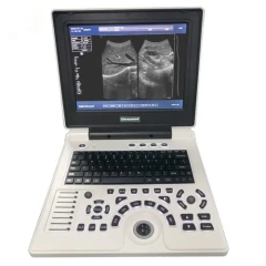 Notebook B/W Ultrasound Machine,Fatali Medical equipment