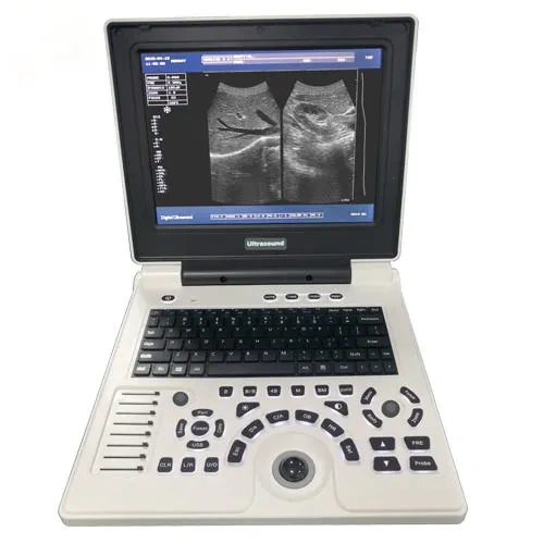 Notebook B/W Ultrasound Machine,Fatali Medical equipment