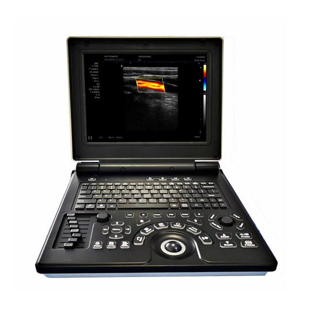 Portable Ultrasound Machine FTL-E20,Fatali Medical equipment