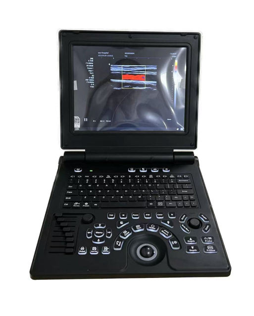 Portable Ultrasound Machine FTL-E20,Fatali Medical equipment