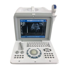Portable B/W Ultrasound Machine FTL-S218,Fatali Medical equipment