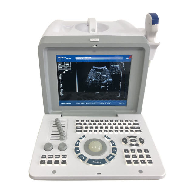 Portable B/W Ultrasound Machine FTL-S218,Fatali Medical equipment