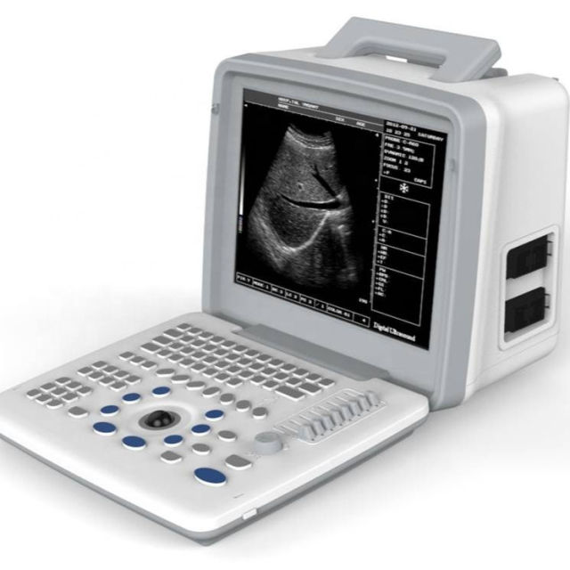 Cheap Portable Ultrasound Machine FTL-S300,Fatali Medical equipment