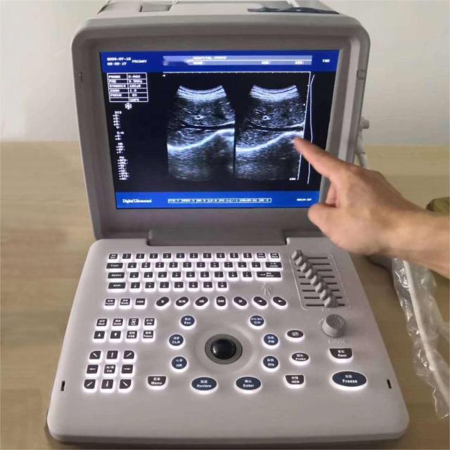 Cheap Portable Ultrasound Machine FTL-S300,Fatali Medical equipment