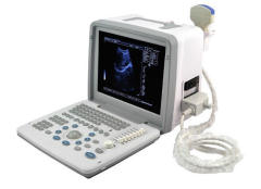Cheap Portable Ultrasound Machine FTL-S300,Fatali Medical equipment