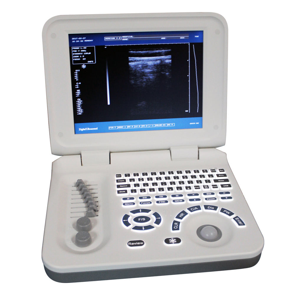 Portable Diagnostic Ultrasound Machine