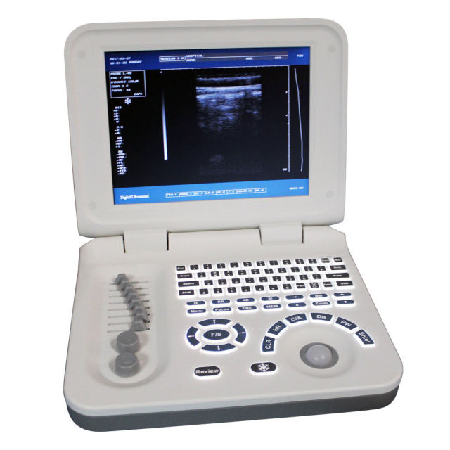 Portable Diagnostic Ultrasound Machine,Fatali Medical equipment
