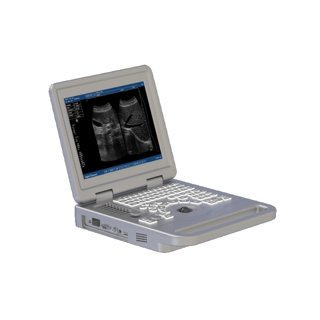 Notebook B/W Ultrasound Machine FTL-S70A,Fatali Medical equipment
