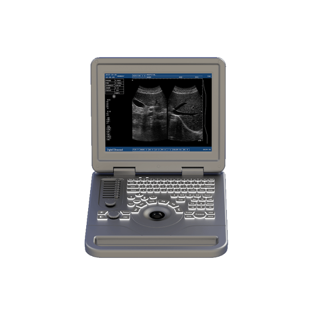 Notebook B/W Ultrasound Machine FTL-S70A,Fatali Medical equipment