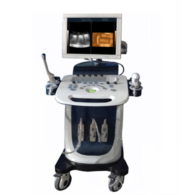 Trolley Color Doppler Ultrasound Machine FTL-S7500,Fatali Medical equipment